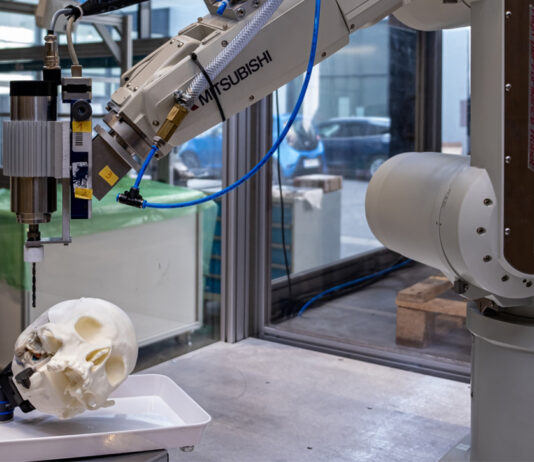 Traumata gering halten