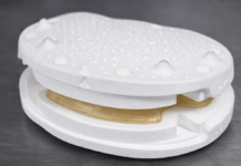 Individuelles Wirbelsäulenimplantat aus dem 3D-Druck