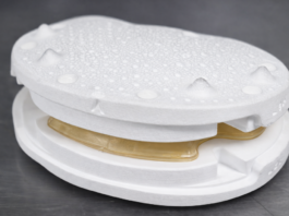 Individuelles Wirbelsäulenimplantat aus dem 3D-Druck