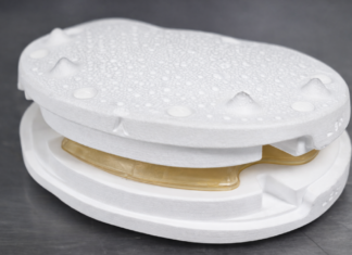 Individuelles Wirbelsäulenimplantat aus dem 3D-Druck